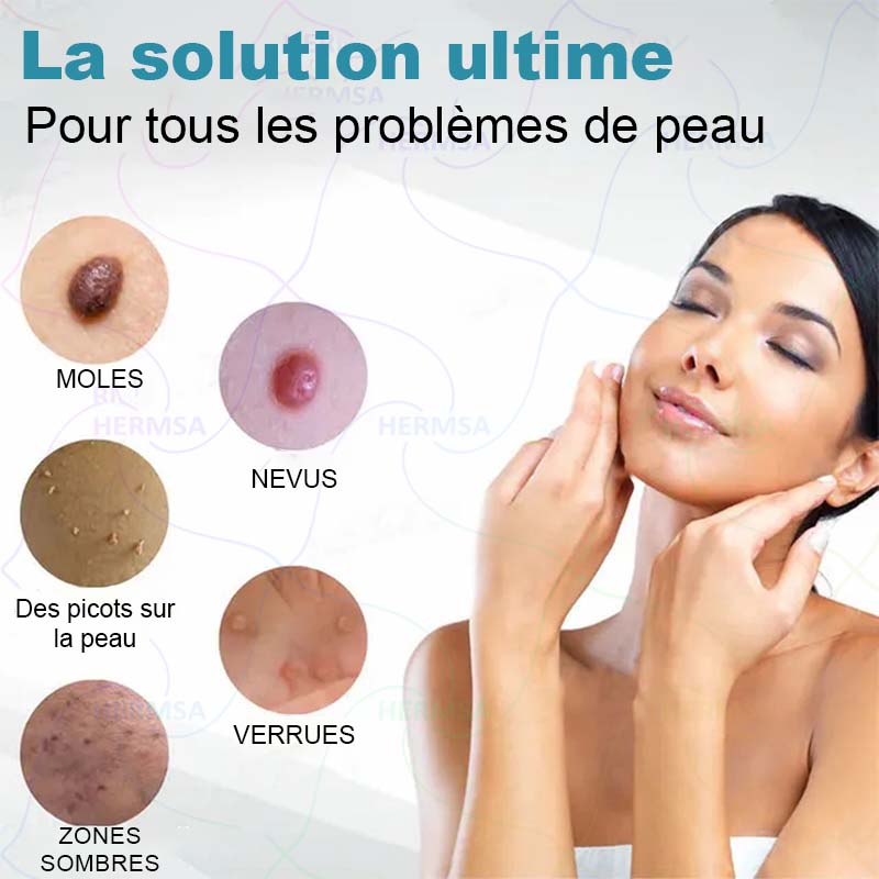 pointeur laser non-invasif - élimination des grains de beauté et des verrues (🔥Dernier jour 80% de réduction)