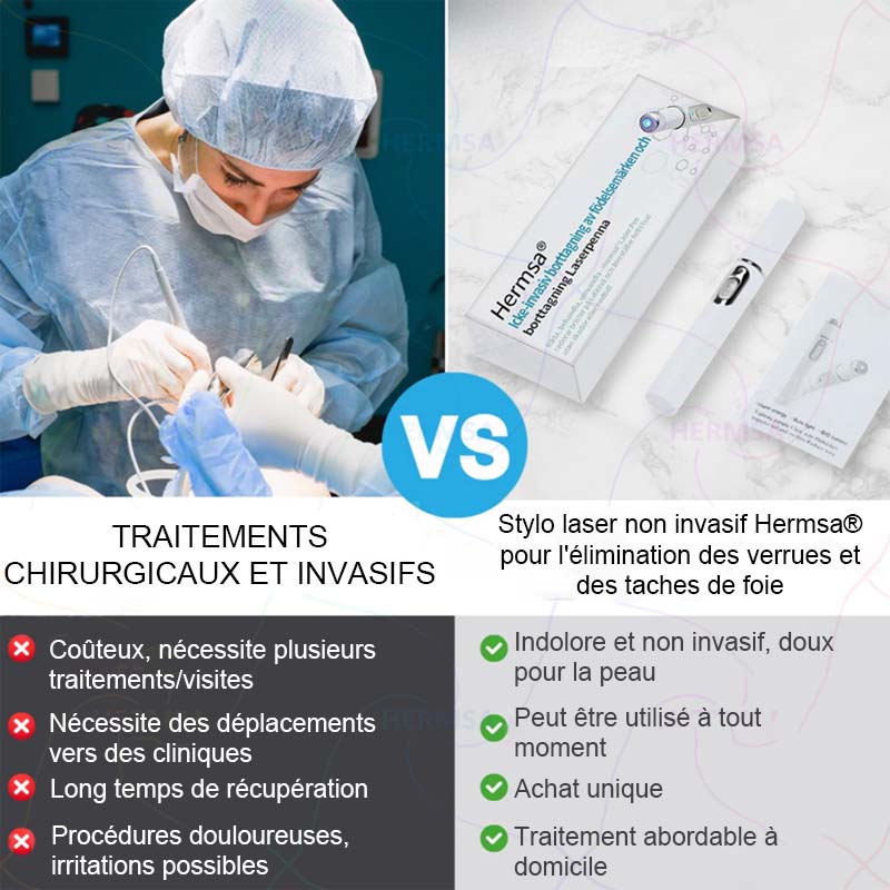 pointeur laser non-invasif - élimination des grains de beauté et des verrues (🔥Dernier jour 80% de réduction)