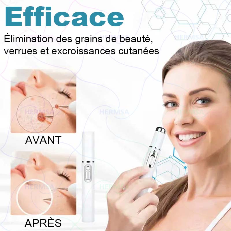pointeur laser non-invasif - élimination des grains de beauté et des verrues (🔥Dernier jour 80% de réduction)